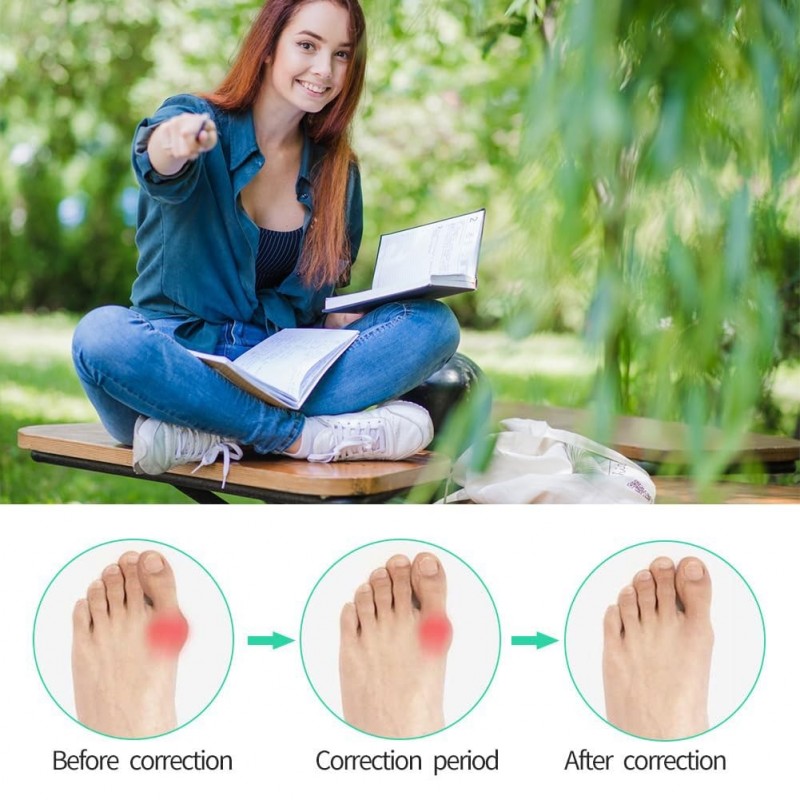 Orthèses Hallux Valgus,Hallux Valgus Correcteur,Gros Redresseur Orteil,Orthese Hallux Valgus,Bunion Corrector,Correction Hallux