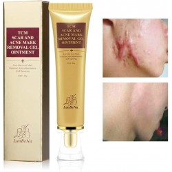 Acne scar cream